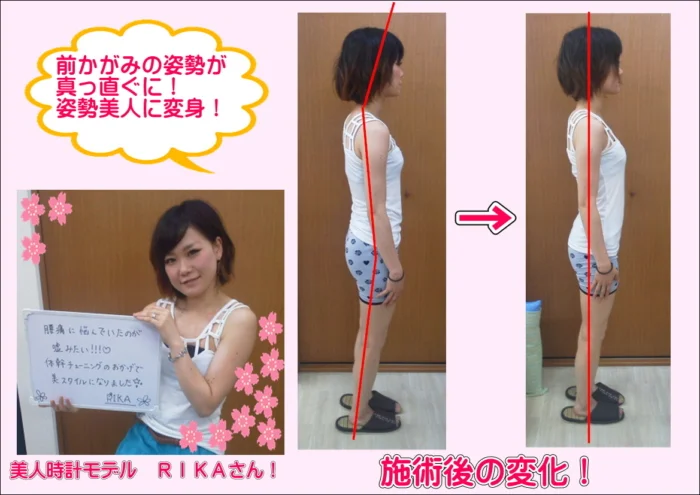 前かがみの姿勢が真っすぐに！姿勢美人に変身！